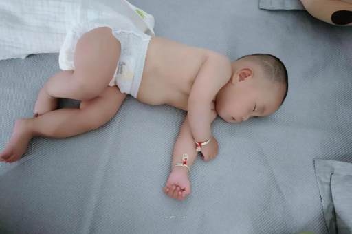 天水六个月宝宝眼睛散光